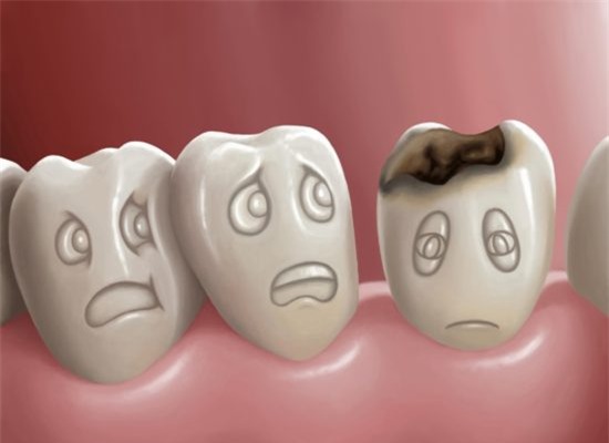 Sâu răng nhiều có thể là dấu hiệu bị đái tháo đường.